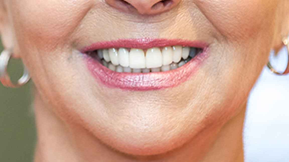 Cosmetic Dentistry in Leesburg