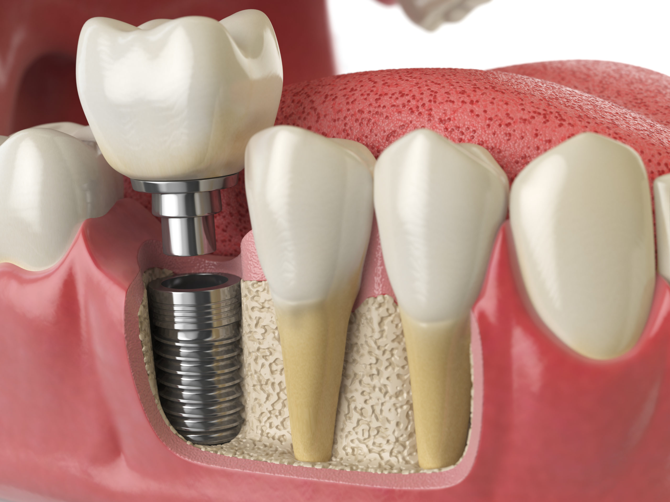 leesburg family dentist